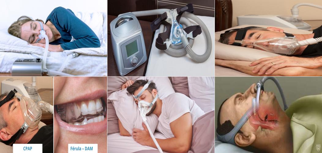 7 beneficios de usar un aparato para apnea del sueño: mejora tu calidad de  vida - Encuentra los mejores productos para tu hogar en parislibreria